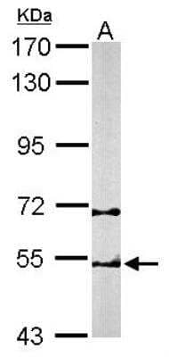 Western Blot: TCP1-beta Antibody [NBP1-33418]