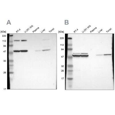Western Blot: TCP1-beta Antibody [NBP1-88146]