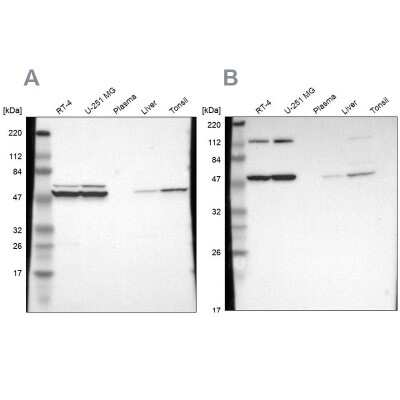 Western Blot: TCP1-beta Antibody [NBP1-88147]