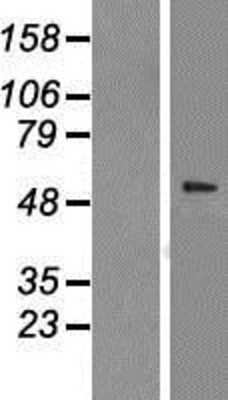 Western Blot: TCP1-beta Overexpression Lysate [NBP2-10412]