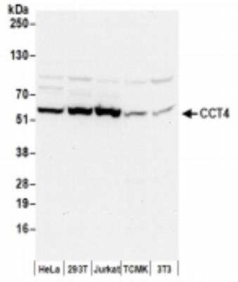 Immunoprecipitation: TCP1-delta Antibody [NBP2-41360]