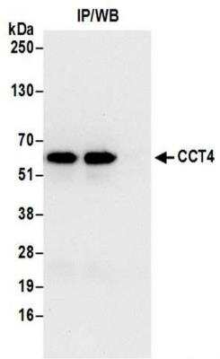Immunoprecipitation: TCP1-delta Antibody [NBP2-41361]