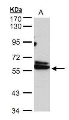 Western Blot: TCP1-delta Antibody [NBP1-32385]