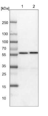 Western Blot: TCP1-delta Antibody [NBP1-88145]