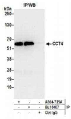 Western Blot: TCP1-delta Antibody [NBP2-41360]