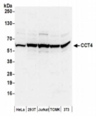 Western Blot: TCP1-delta Antibody [NBP2-41361]