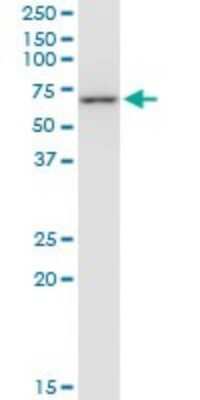 Western Blot: TCP1-eta Antibody (1D6) [H00010574-M01]