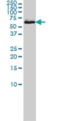 Western Blot: TCP1-eta Antibody (1D6) [H00010574-M01]