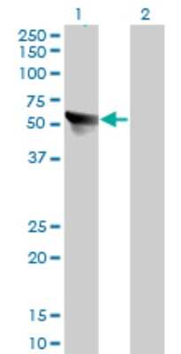 Western Blot: TCP1-eta Antibody (1D6) [H00010574-M01]