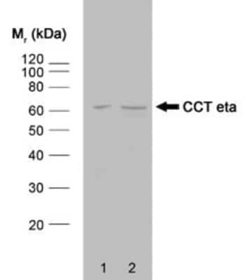 Western Blot: TCP1-eta Antibody (PK/16/8/a)BSA Free [NB100-66571]