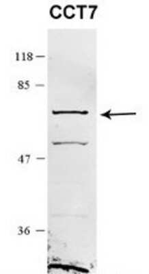 Western Blot: TCP1-eta Antibody [NBP1-58218]