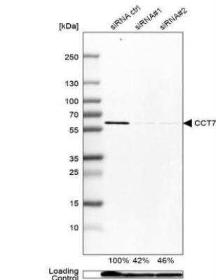 Western Blot: TCP1-eta Antibody [NBP1-88144]