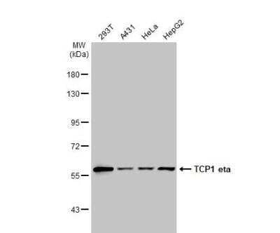 Western Blot: TCP1-eta Antibody [NBP2-20588]