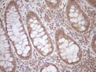 Immunohistochemistry: TCP10 Antibody (OTI2C2) [NBP2-46090]