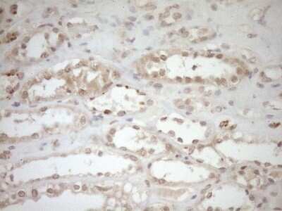Immunohistochemistry: TCP10 Antibody (OTI2C2) [NBP2-46090]