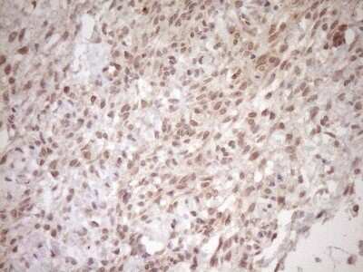 Immunohistochemistry: TCP10 Antibody (OTI2C2) [NBP2-46090]