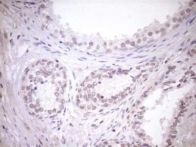Immunohistochemistry: TCP10 Antibody (OTI2C2) [NBP2-46090]