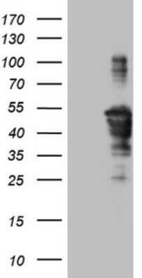 Western Blot: TCP10 Antibody (OTI2C2) [NBP2-46090]