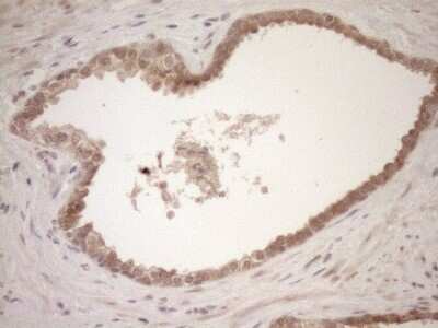 Immunohistochemistry: TCP10 Antibody (OTI2C2) - Azide and BSA Free [NBP2-74474]