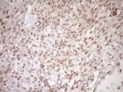 Immunohistochemistry: TCP10 Antibody (OTI2C2) - Azide and BSA Free [NBP2-74474]