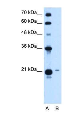 Western Blot: TCP10L Antibody [NBP1-52846]