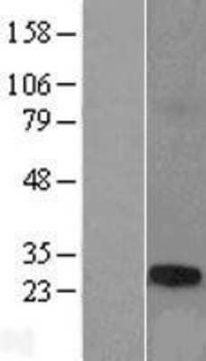 Western Blot: TCP10L Overexpression Lysate [NBL1-16788]