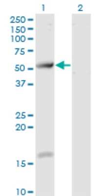 Western Blot: TCP11 Antibody (2E3) [H00006954-M07]