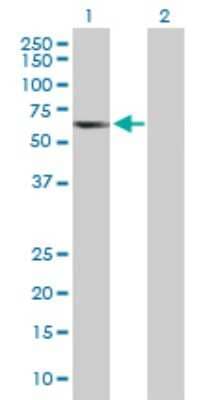 Western Blot: TCP11 Antibody [H00006954-B01P]