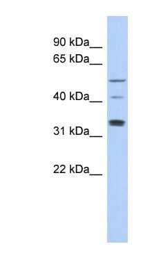 Western Blot: TCP11 Antibody [NBP1-56519]