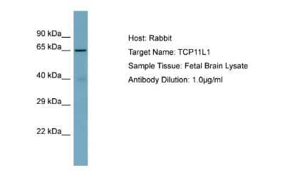 Western Blot: TCP11L1 Antibody [NBP2-83634]