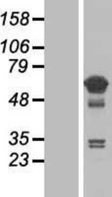 Western Blot: TCP11L1 Overexpression Lysate [NBL1-16789]