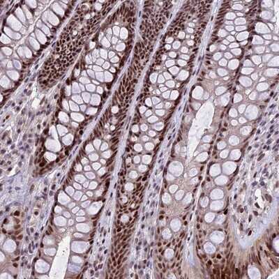 Immunohistochemistry-Paraffin: TCP11L2 Antibody [NBP1-82694]
