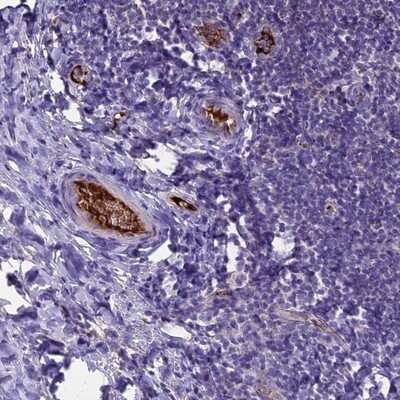 Immunohistochemistry-Paraffin: TCP11L2 Antibody [NBP1-82695]