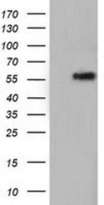 Western Blot: TCP11L2 Antibody (OTI2A10)Azide and BSA Free [NBP2-74477]