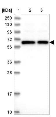 Western Blot: TCP11L2 Antibody [NBP1-82694]