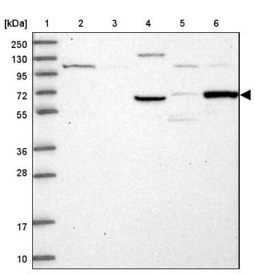 Western Blot: TCP11L2 Antibody [NBP1-82695]