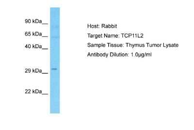 Western Blot: TCP11L2 Antibody [NBP2-88426]