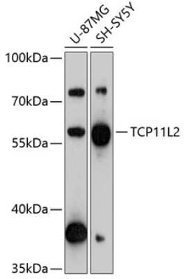 Western Blot: TCP11L2 AntibodyAzide and BSA Free [NBP2-93924]