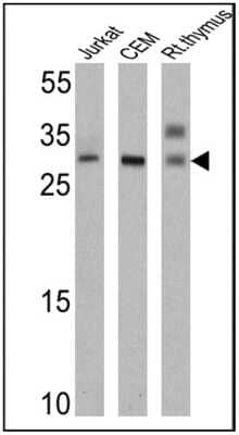 Western Blot: TCR V alpha 12.1 Antibody (6D6.6) [NBP2-22491]