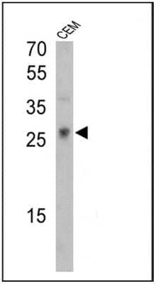 Western Blot: TCR gamma/delta Antibody (7A5) [NBP2-22510]