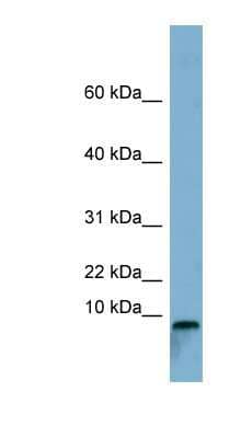 Western Blot: TCTA Antibody [NBP1-59828]