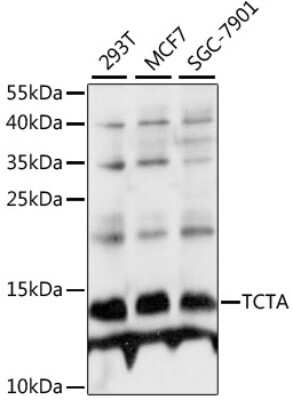 Western Blot: TCTA AntibodyAzide and BSA Free [NBP2-94682]