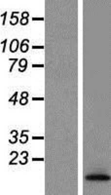 Western Blot: TCTA Overexpression Lysate [NBP2-06451]