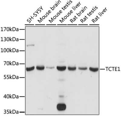 Western Blot: TCTE1 AntibodyAzide and BSA Free [NBP2-94592]