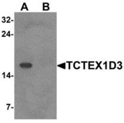 Western Blot: TCTE3 AntibodyBSA Free [NBP2-81956]