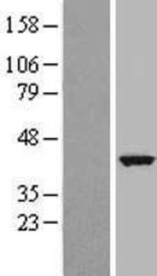 Western Blot: TCTE3 Overexpression Lysate [NBP2-05096]