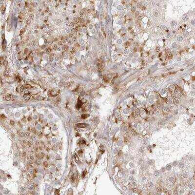Immunohistochemistry-Paraffin: TCTEX1D1 Antibody [NBP1-93777]