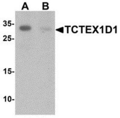 Western Blot: TCTEX1D1 AntibodyBSA Free [NBP2-81830]