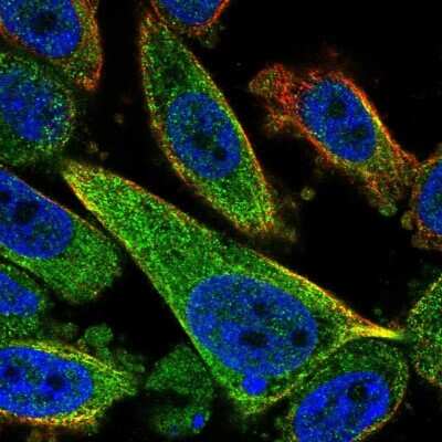 Immunocytochemistry/ Immunofluorescence: TCTEX1D2 Antibody [NBP2-13422]