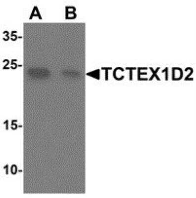 Western Blot: TCTEX1D2 AntibodyBSA Free [NBP2-81831]